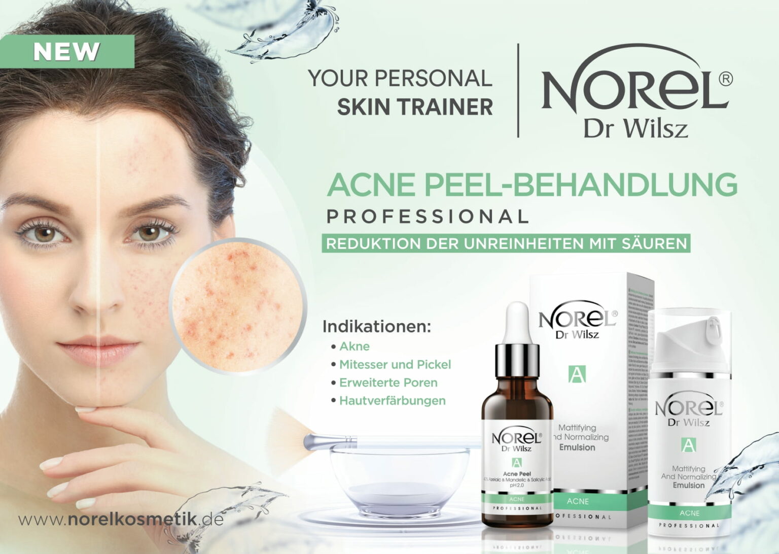 ACNE PEEL-1